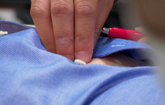 Wireless Ultrasound Wireless Ultrasound